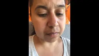 Красота требует жертв. Хожу на уколы. Десна