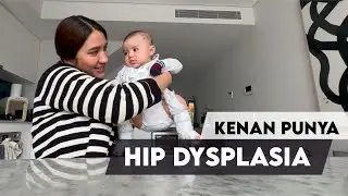 Kenan ternyata punya Hip Displasia.