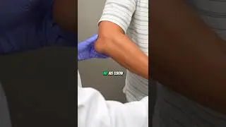 What happened to his elbow?!😱 