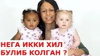 ИККИ ХИЛ РАНГЛИ ЭГИЗАКЛАР ХАКИДА кизик маълумот