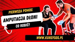 Amputacja dłoni #pierwszapomoc