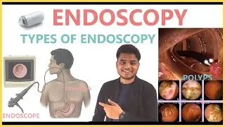 ENDOSCOPY | TYPES OF ENDOSCOPY & CAPSULE ENDOSCOPY || RJDS MEDIX