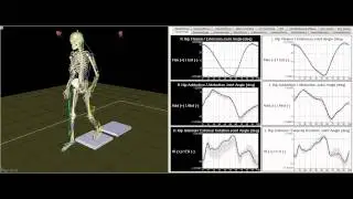 Gait Motion Analysis Technology - Motion Analysis