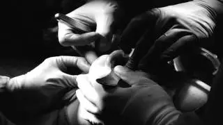 Dr. Kenneth E. Salyer-How the Craniofacial Surgery gas Changed over the Years