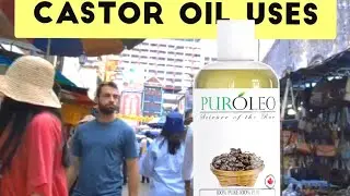 Top 7 Uses Of Castor Oil Interesting Benefits