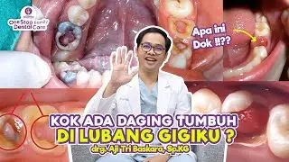 Pulp Polyp! Flesh grows in the middle of a cavity in the tooth.