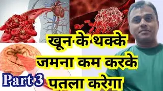 Best Homeopathic medicines to dissolve blood clots and thinning blood