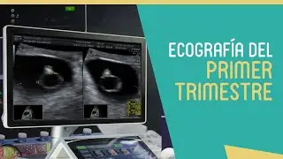 Ecografía Primer Trimestre @DraAdelitaHijarSifuentes