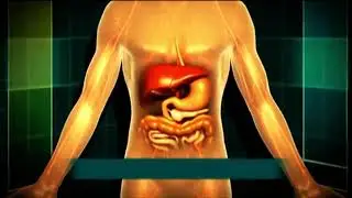 What is Diabetes [English]