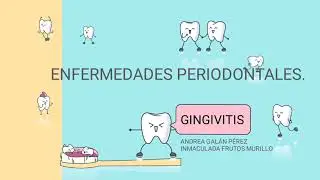Enfermedades Periodontales: La Gingivitis