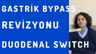BAŞARISIZ GASTRİK BYPASS’ın DUODENAL SWITCH ‘e REVİZYONU