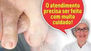 PELE FINA E RESSECADA EM PESSOA DIABÉTICA