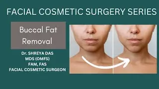 Face Slimming Surgery | Buccal Fat removal Surgery by Dr. Shreya Das