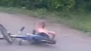 Открытый перелом, упал с велика