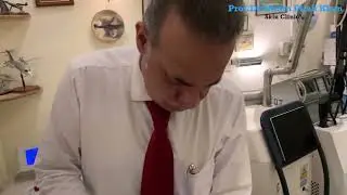 Considering Excimer 308 for Vitiligo? Watch This! #vitiligo #lasertreatment