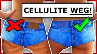 Cellulite behandeln reduzieren und vorbeugen - so gehts effektiv!