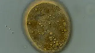 Is that the Moon? Nope, it's a Ciliate
