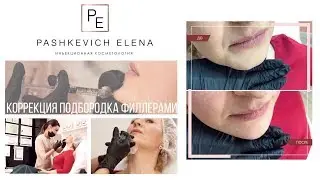 Коррекция подбородка, Углы нижней челюсти, Подтянутый овал лица, Как убрать брыли