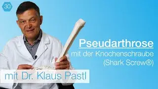 #30 Shark Screw® / Knochenschraube bei Pseudarthrose - was wirklich hilft / Expertengespräch