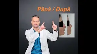 Până şi după. Operații estetice.