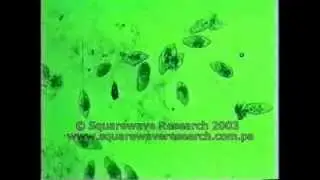 Rife Machine Killing Bacteria