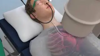 CHEST Foundation - Learn About Lung Biopsies