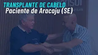Transplante capilar em paciente que veio de Aracaju (SE)