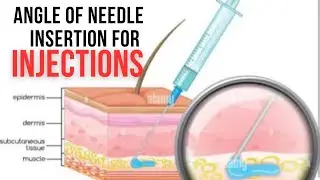 ANGLE OF NEEDLE INSERTION FOR INJECTIONS || INJECTION TECHNIQUE : IM, Subcute, , IV, ID. #injection
