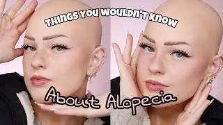 Things you wouldn’t know about having Alopecia