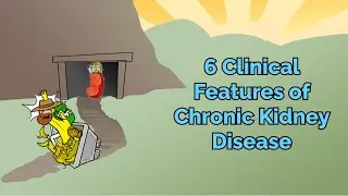 6 Clinical Features of Chronic Kidney Disease (Step 1, COMLEX, NCLEX®, PANCE, AANP)