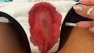 NOSSA MENSTRUAÇÃO NÃO TEM CHEIRO RUIM