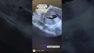 Халатность врачей или преднамеренный обман!?  Главное что сейчас все у меня отлично 💖