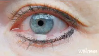 What is evaporative dry eye and how to treat it