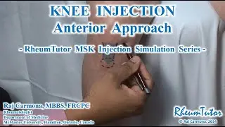 Knee Injection - Anterior Approach