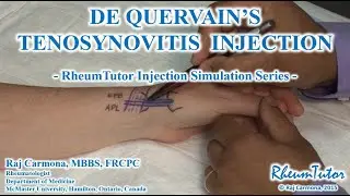 DeQuervain's Tenosynovitis Injection