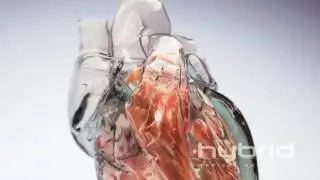 Glass Heart (Hybrid Medical Animation) HD