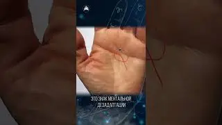 О чем говорит изломанная линия жизни