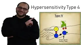 Hypersensitivity type 4