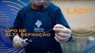 Lipo DE ALTA DEFINIÇÃO (LAD): entre comigo em cirurgia!