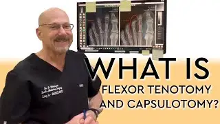 What is Flexor Tenotomy and Capsulotomy?