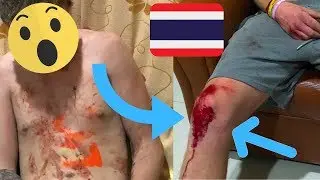 MY SHOCKING FIGHT STORY -  KOH TAO... You Won't Believe this!