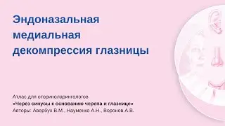 Эндоназальная медиальная декомпрессия глазницы. Операцию проводит Алексей Владимирович Воронов.