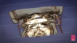 CT Data to 3D Print Workflow
