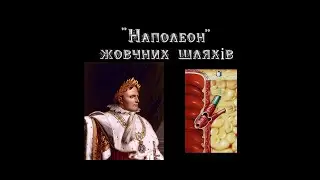 "Наполеон" жовчних шляхів