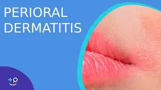Perioral Dermatitis - Daily Do's of Dermatology