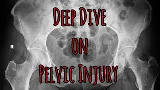 Prolonged Field Care Podcast 173: Deep Dive on Pelvic Injury