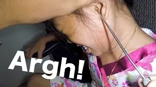 How to Remove an Unknown Foreign Body STUCK in Girl's EAR  | What is it?