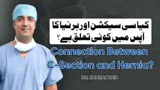 Do C-Section and Hernia Have a Link? | Dr. Kamran Zaib Explains Types of Hernia in Women