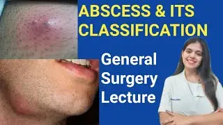 Abscess and it's classification l GENERAL SURGERY Lecture