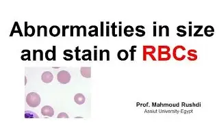 Abnormal size and stain of RBCs !